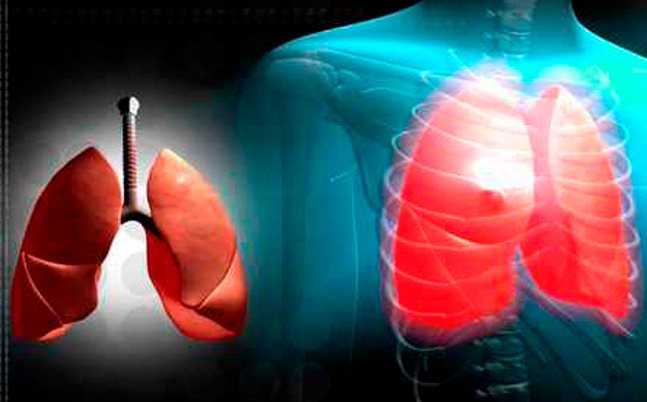 Programa de Trasplante Pulmonar